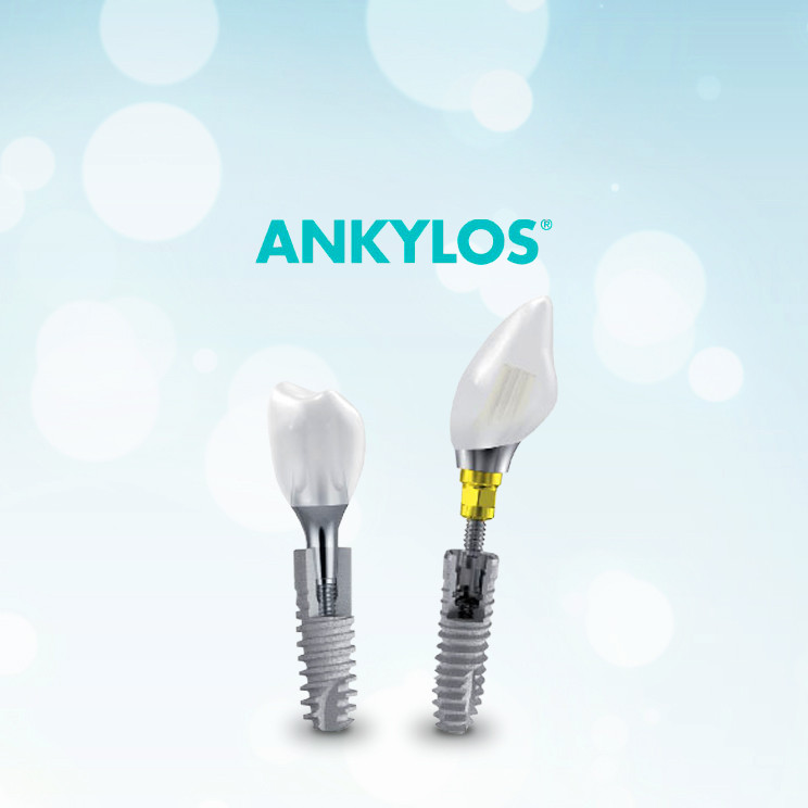 Имплант Ankylos