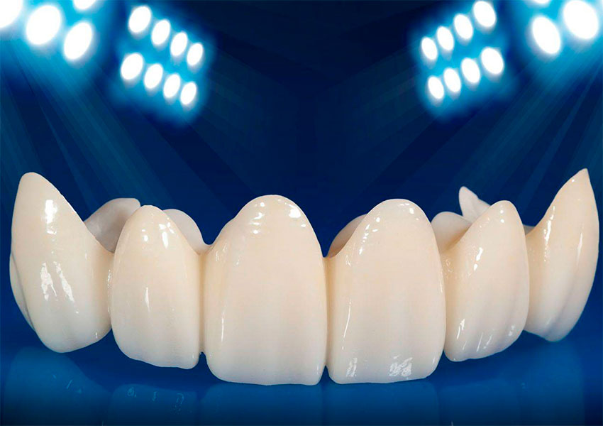 Коронка диоксид циркония премиум. Зубы диоксид. Зубы диоксид. Зубы диоксид. Керамическая коронка диоксид циркония.